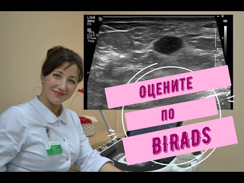 Оцените по BIRADS образования молочной железы