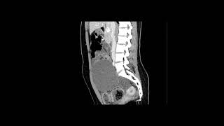 Abdominal Case Conference 2025 - Session 31