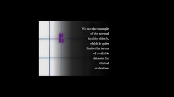 Multivariate Multi-Scale Permutation Entropy for Complexity Analysis of Alzheimer’s D... | RTCL.TV