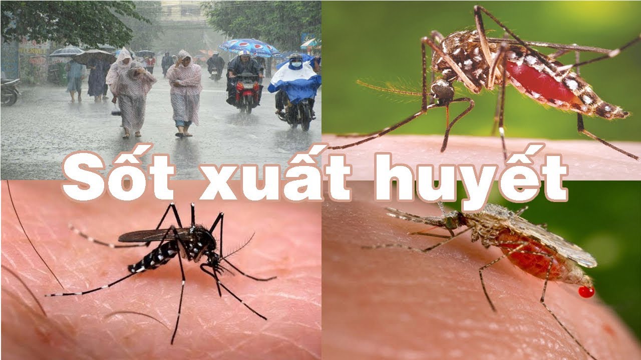 Bệnh sốt xuất huyết Mùa mưa cảnh giác với dịch sốt... - youtube