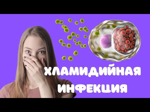 Хламидийная инфекция (для врачей)