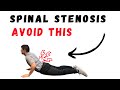 Spinal Stenosis core exercises for pain relief