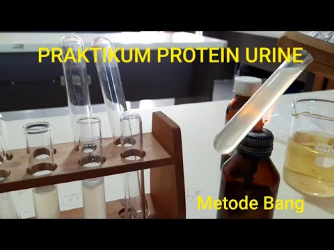 Video: Pencirian Kuantitatif Metabolit Air Kencing Dan Serum Kanak-kanak Adalah Penting Untuk Kajian 'omics