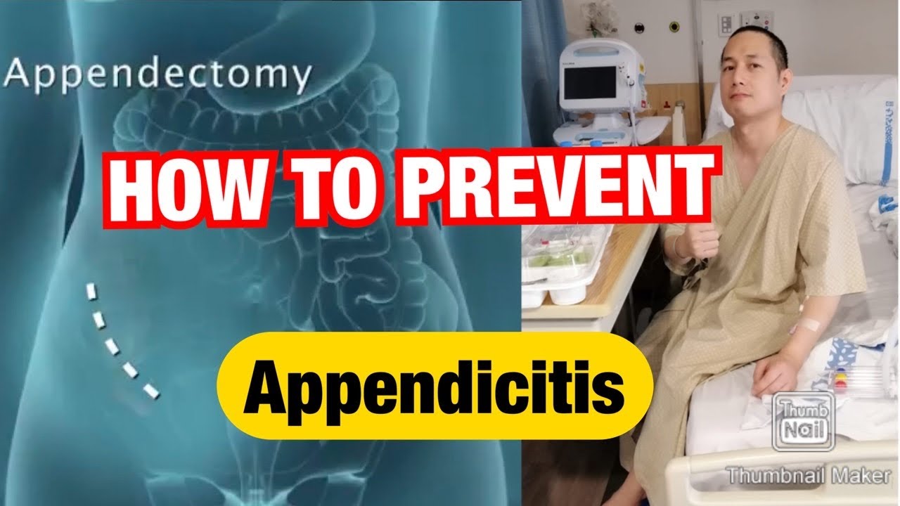 Paano maiiwasan ang Appendicitis, Naoperahan ako sa Apendix - YouTube