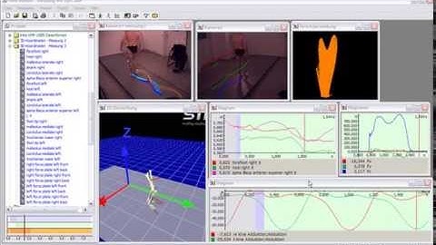 Gait Analysis 3D with Simi Motion