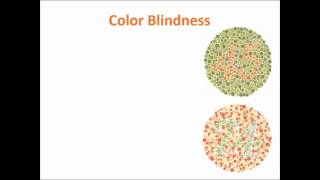 Celebrity Exploring Psych Ch 6 Color vision Wealth