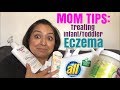 MOM TIPS: Treating Infant/Toddler Eczema