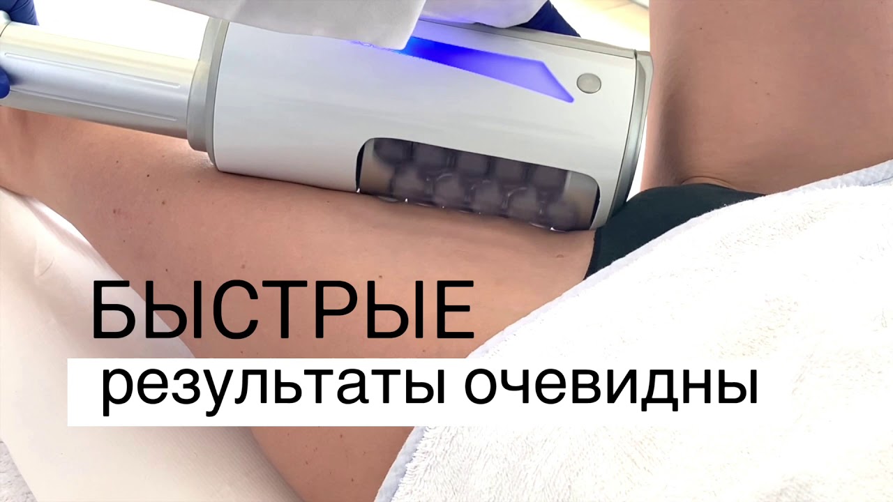 Endospheres® Therapy - эффективность, которую вы хотите. Безопасность, которую вы ищете.