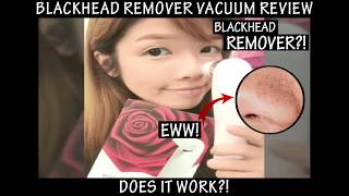 Premium Blackhead Remover Vacuum Suction Device Pore Clean Machine Review