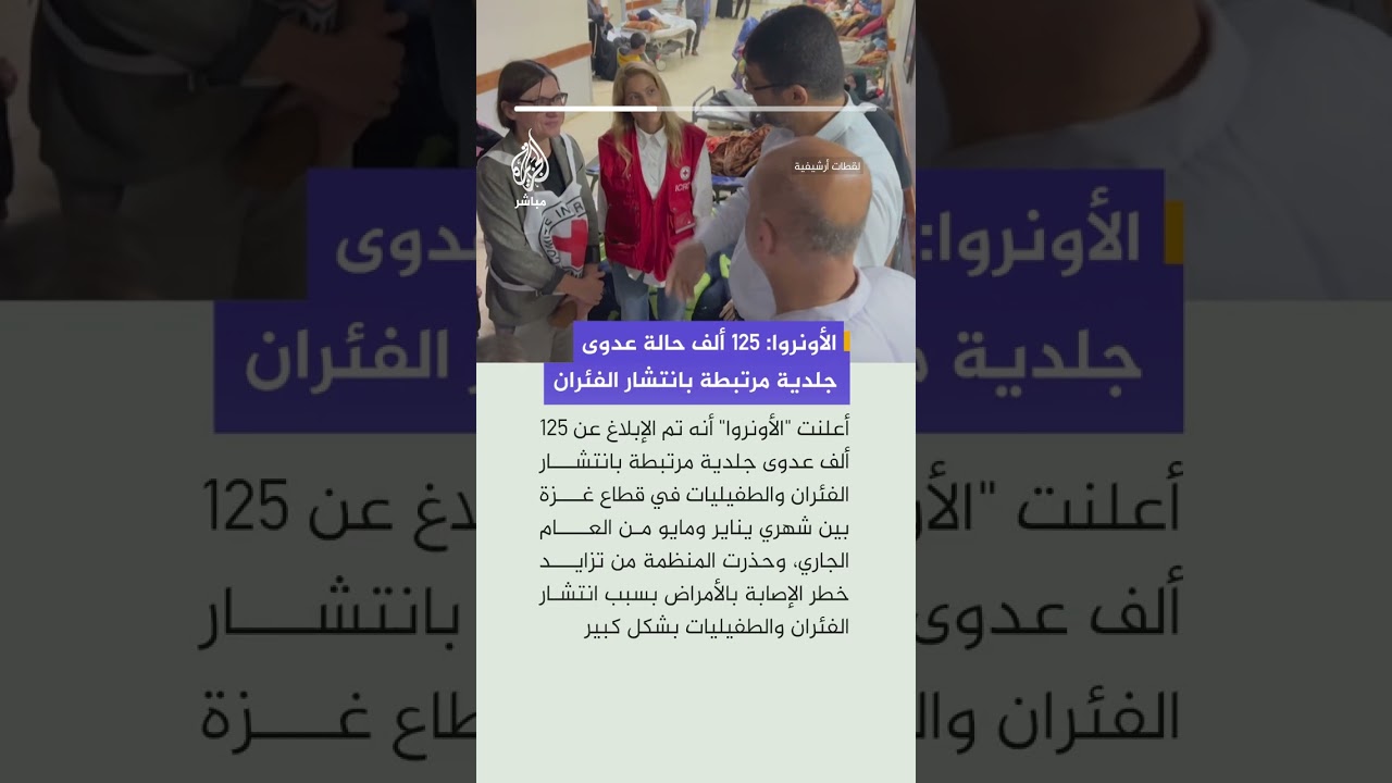 الأونروا: 125 ألف حالة عدوى جلدية مرتبطة بانتشار الفئران والطفيليات في غزة