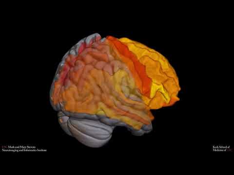 Animation Links White Matter to Language Ability in Aging