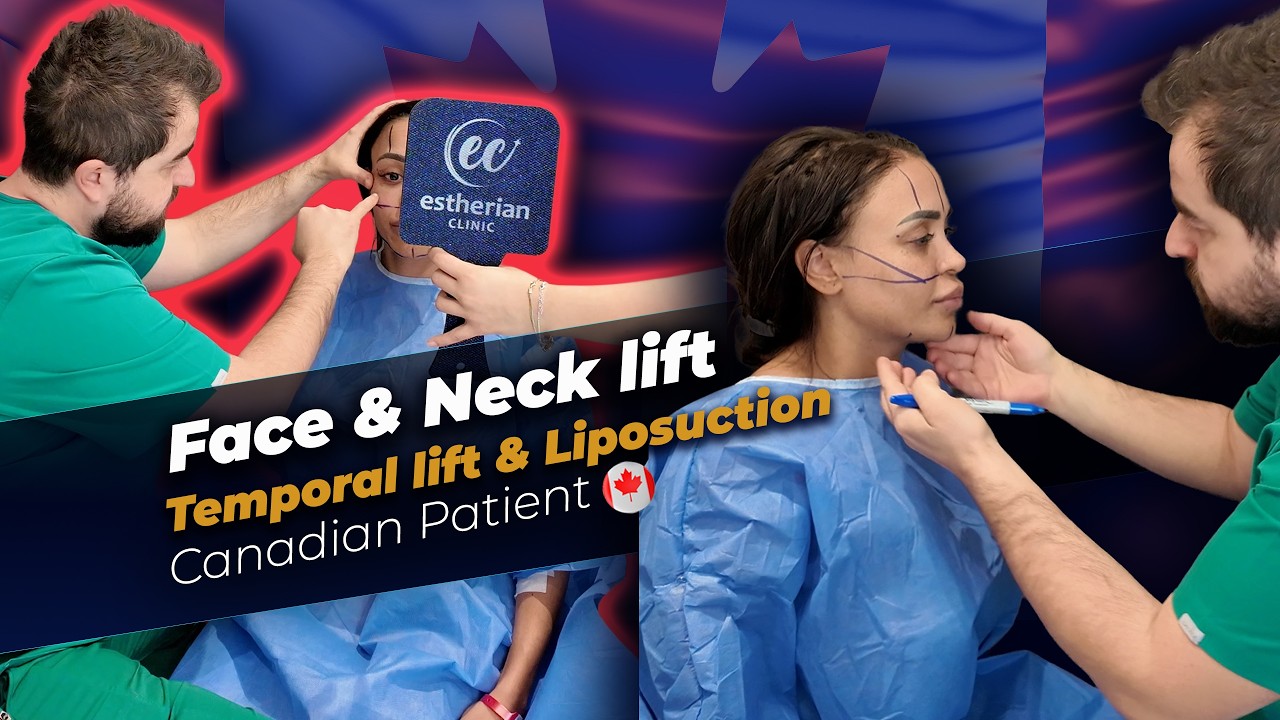 The First Step to My New Me 🤍 | Plastic Surgery in Turkey ✨