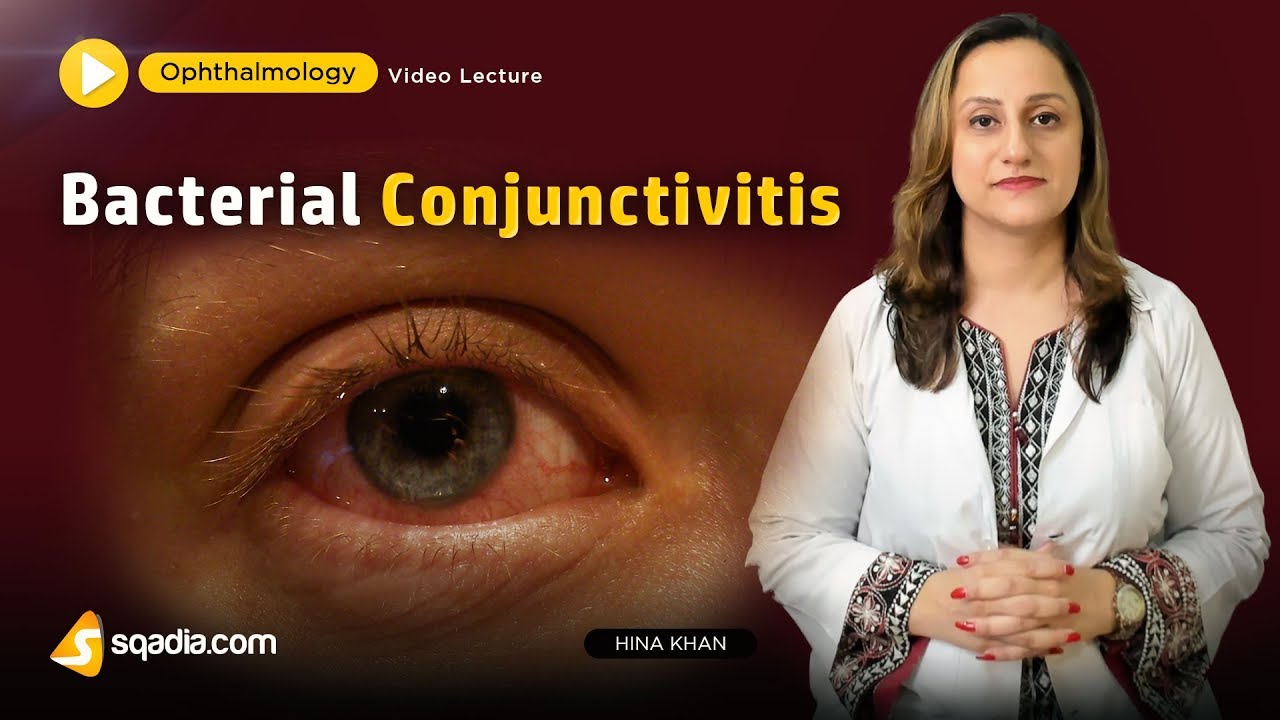 Bacterial Conjunctivitis | Ophthalmology Video Lecture | Medical Student V-Learning