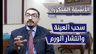 الأسئلة المتكررة.. هل يسبب سحب العينة انتشارا للورم؟