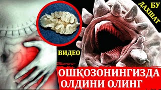 ОШҚОЗОНИНГИЗ ХАВФ ОСТИДА НОТЎҒРИ ОВҚАТЛАНИШ САБАБ