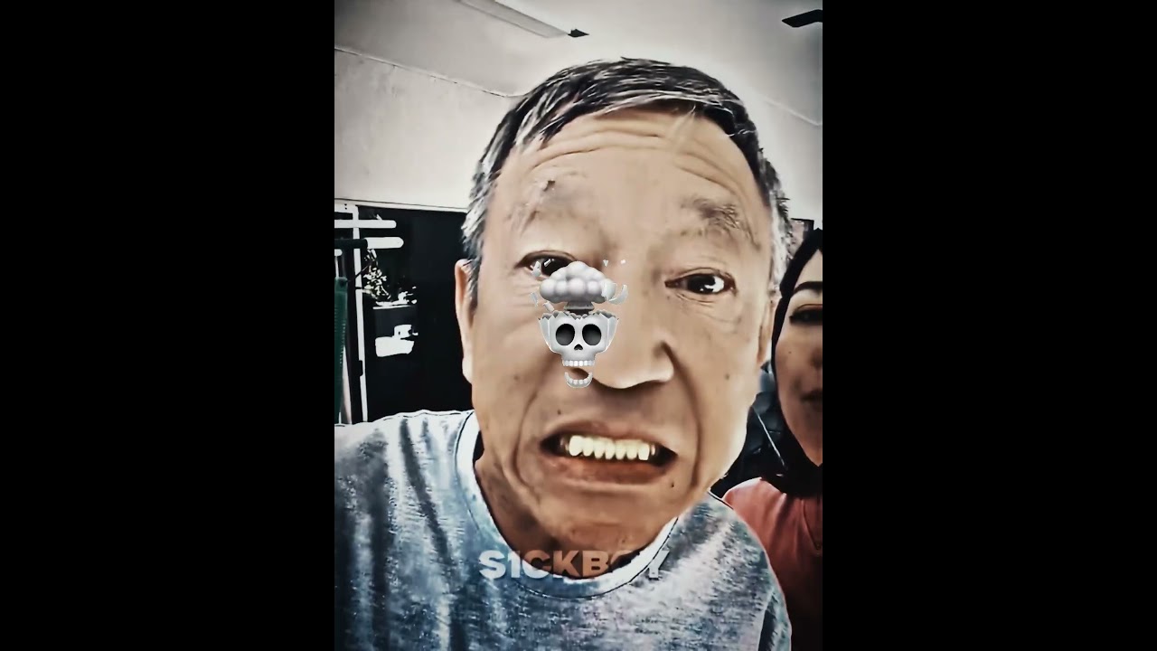 Yellow Teeth Filter Prank 💀