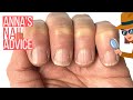 RIDGY NAILS? THE ONLY SOLUTION. [ANNA'S NAIL ADVICE]