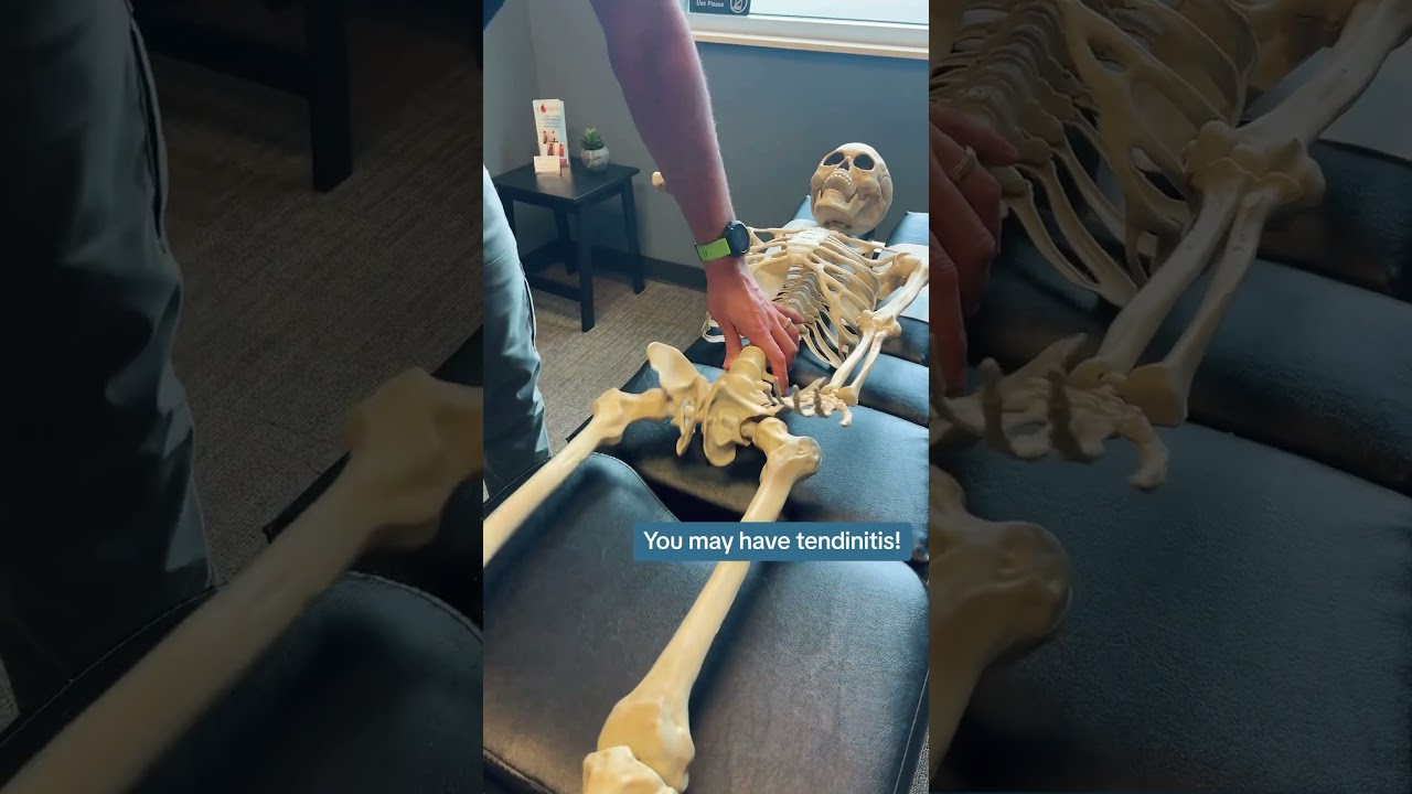 Bone Jangles - Hip/SI Joint Pain - Hip Pain in Springfield Missouri 