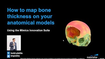 How to Map Bone Thickness on Your Anatomical Models | Materialise Mimics 22
