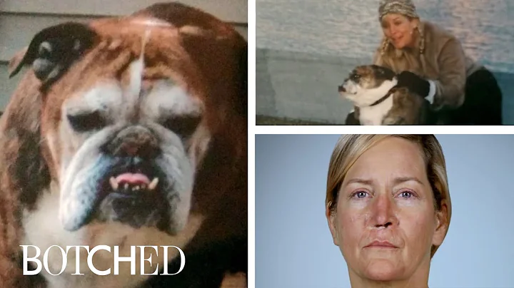 The Most Brutal "Botched" Accidents | E!