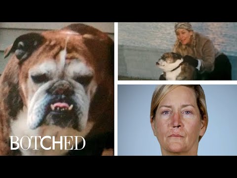 The Most Brutal "Botched" Accidents | E!