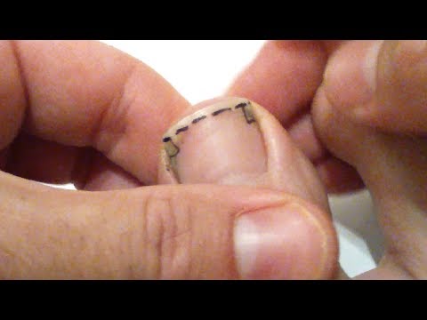 Vidéo: Peut-on couper les ongles trempés ?