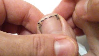 Tuto: Comment bien se couper les ongles de pied pour éviter tout ongle incarné (manière, technique)