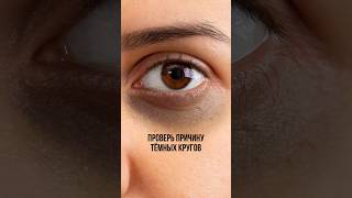 А какой результат у вас? #уходоваякосметика #уходзалицом #патчи #патчидляглаз
