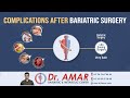 Complications after bariatric and metabolic surgeries  dr v amar obesity surgeon   96766 75646