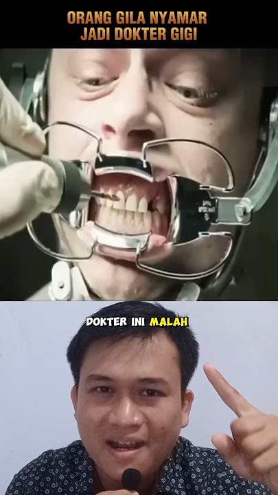 KETIKA ORANG GILA NYAMAR JADI DOKTER GIGI‼️#shorts #alurcerita #storytelling
