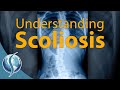 Understanding Scoliosis