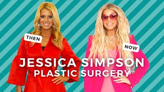 Has Jessica Simpson had Plastic Surgery on her lips?