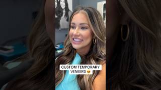 Custom Temporary Veneers! Final Reveal Coming Soon! #smilemakeover #veneers #cosmeticdentistry #htx