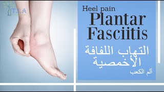 ألم الكعب (العقب) - التهاب اللفافة الأخمصية   Heel pain - Plantar fasciitis (subtitled)