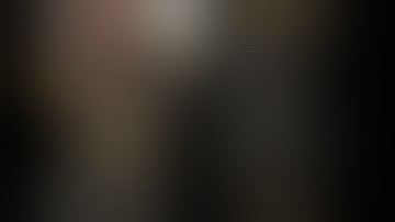 Dr. Kiran Ladkat - 2 (c) Dorsal Dislocations PIPJ - Open Reduction