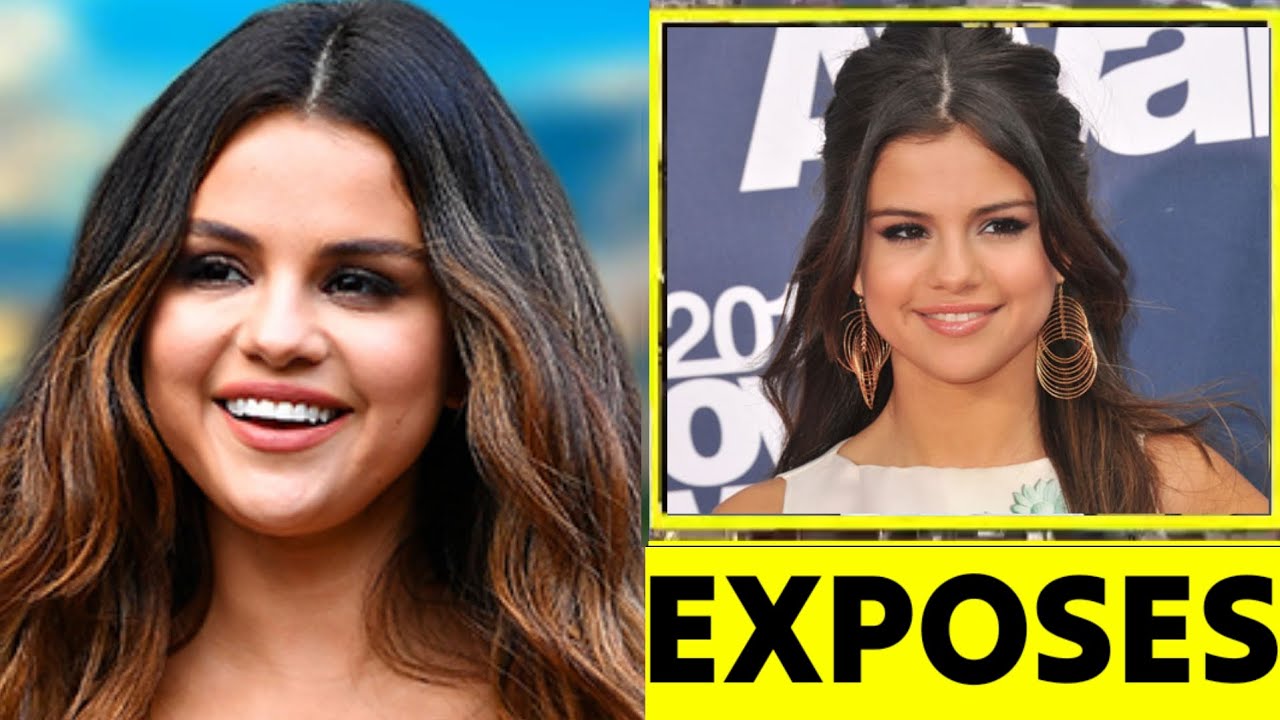 EXPOSES🛑 Selena Gomez's Shocking Revelations About Mental Health YouTube