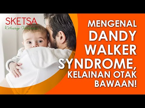 Mengenal Dandy Walker Syndrome, kelainan otak bawaan!  |  Sketsa Kelulaqrga Indonesia