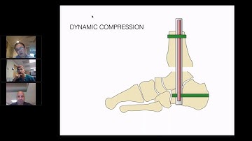 MedShape WEBINAR: Compress Your Way to Success Part 1 with Dr. Shibuya
