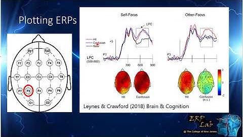 Introduction to FN400 and LPC ERP components