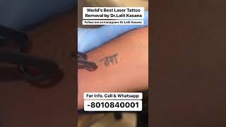 world's best laser tattoo removal by Dr. Lalit Kasana's