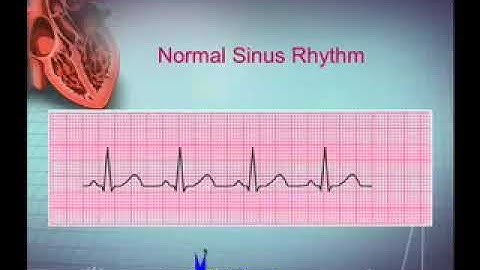 Jaykick Studio - Intro EKG Interpretation Part 1