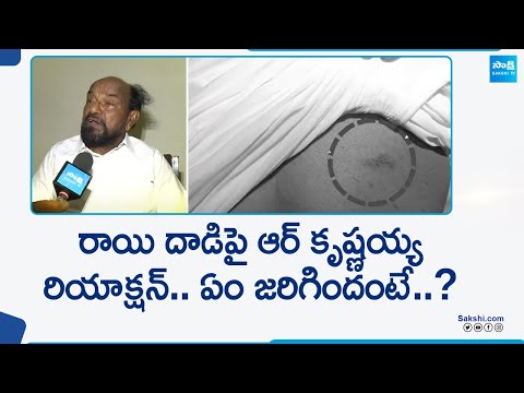 రాజ్యసభ ఎంపీ ఆర్ కృష్ణయ్య పై రాయి దాడి..| Rajya Sabha MP R Krishnaiah Clarity About Attack @SakshiTV - SAKSHITV