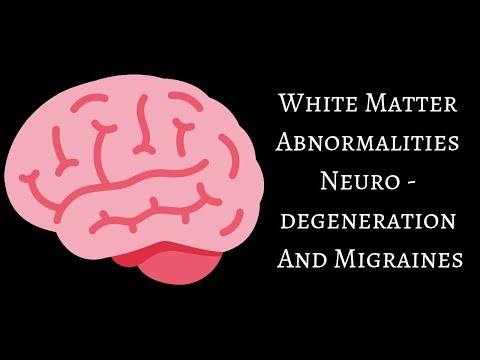 White Matter Abnormalities,