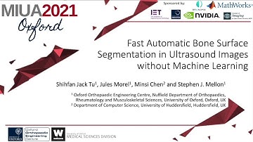 MIUA2021: Fast Automatic Bone Surface Segmentation in Ultrasound Images Without Machine Learning