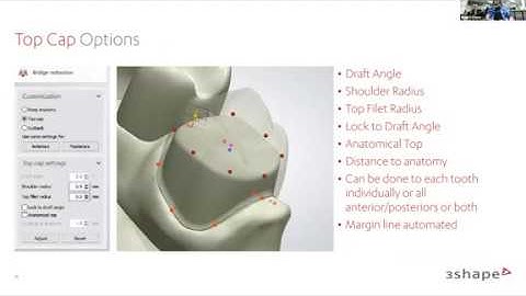 Digital Dentistry Training Series: What’s New in 3Shape 2020