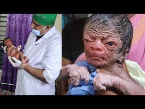 Video: A Hairy Baby Was Born In An Indian Family Of Hairy Women - Alternative View