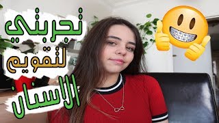 تجربتي لتقويم الأسنان | كل شي لازم تعرفوه عن تقويم الاسنان