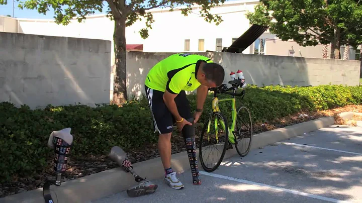 Amputee Profile - Mabio Costa