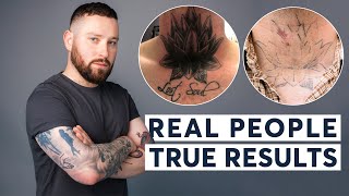 Laser Tattoo Removal  |  Real People, True Results