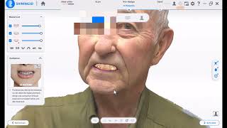 Stitching Facial Scans and Orienting Your Waxup to the Face
